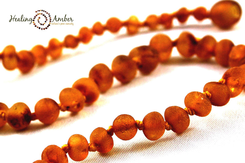 Baltic Amber Healing Necklace - Infant Size 11"