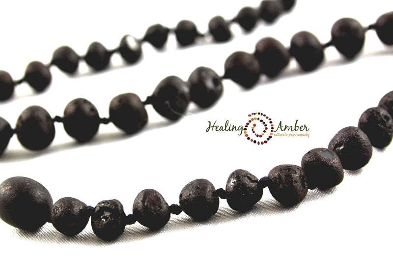 Baltic Amber Healing Necklace - Infant Size 11"