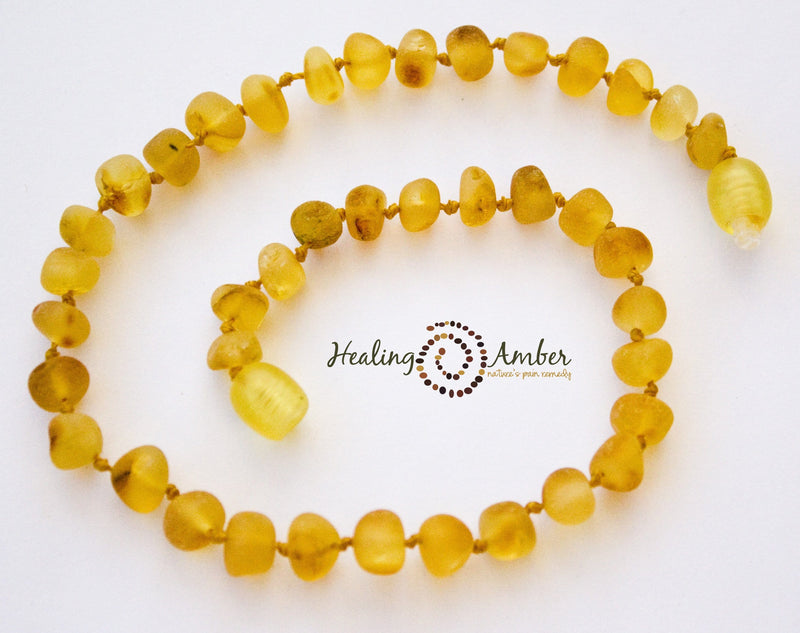 Baltic Amber Healing Necklace - Infant Size 11"