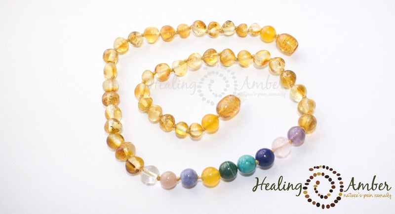 Baltic Amber Healing Necklace - Adult Size 20"-22"